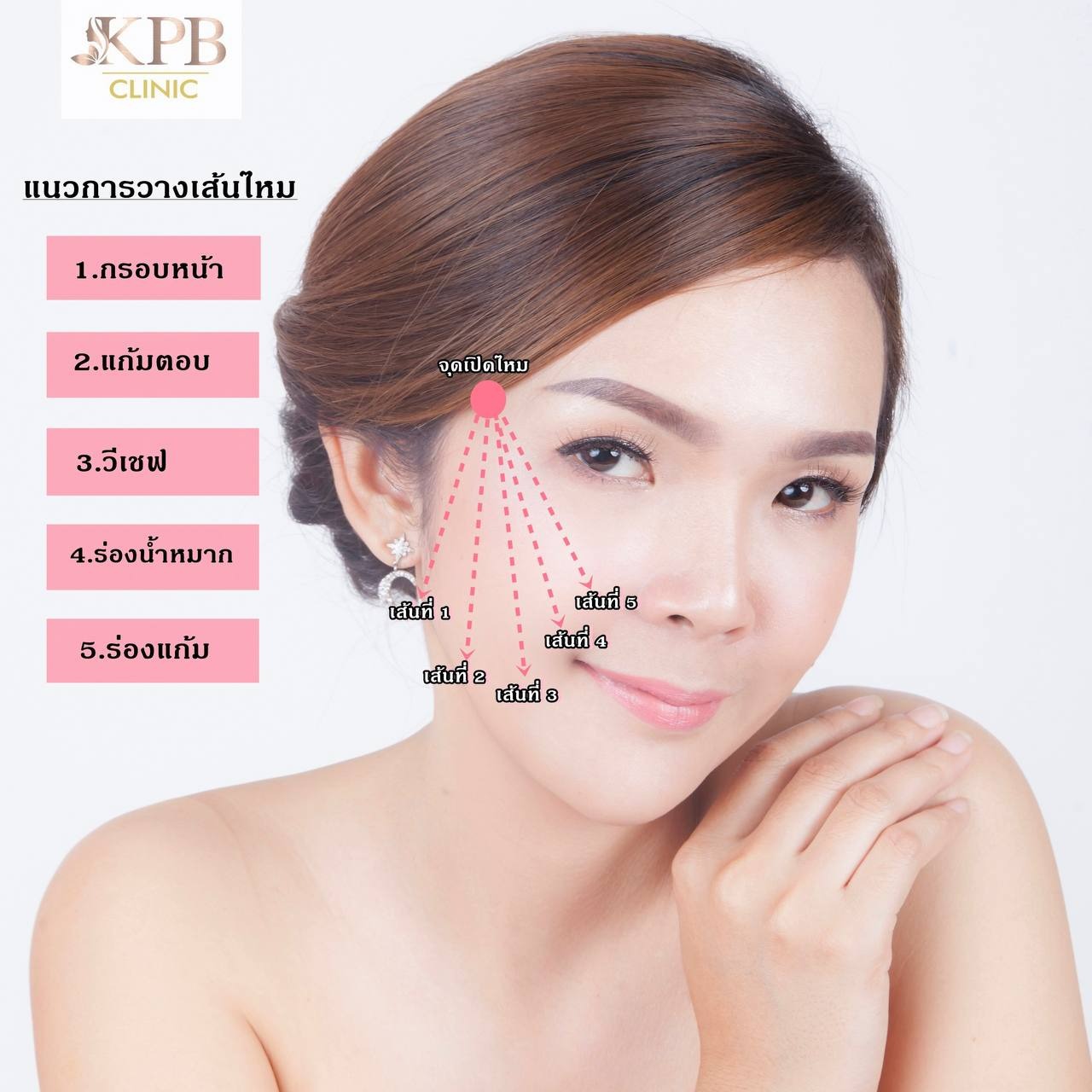 แนวการวางเส้นไหม KPB Clinic